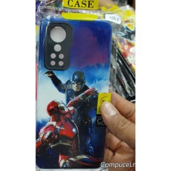 Funda uso rudo con diseño para AXON 30 5G